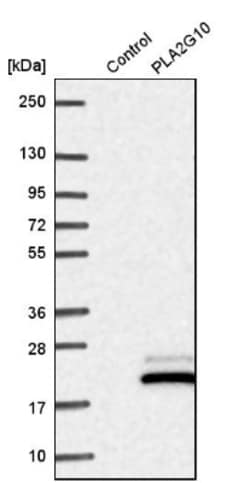 PLA2G10 Antibody, Novus Biologicals:Antibodies:Primary Antibodies